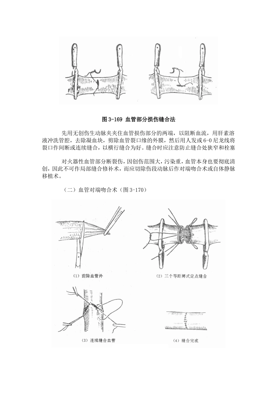 血管损伤的处理_第3页