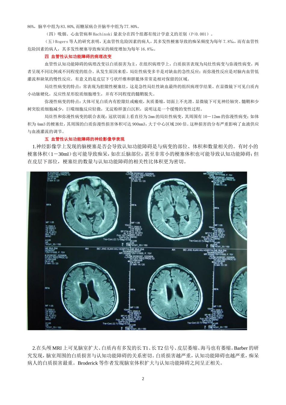 血管性认知功能障碍的诊断与治疗_第2页