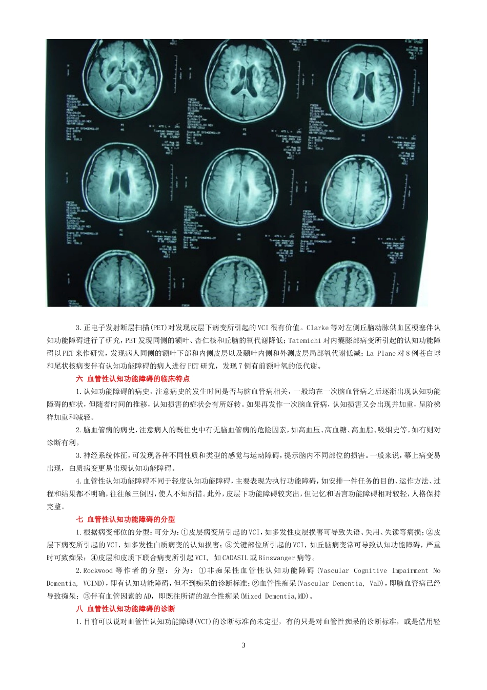 血管性认知功能障碍的诊断与治疗_第3页