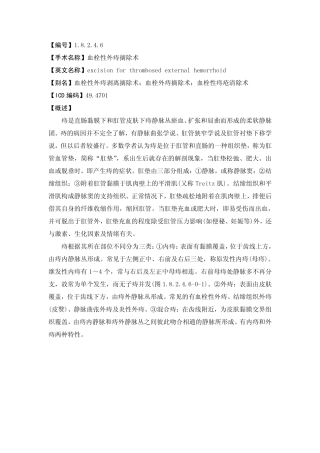血栓性外痔摘除术