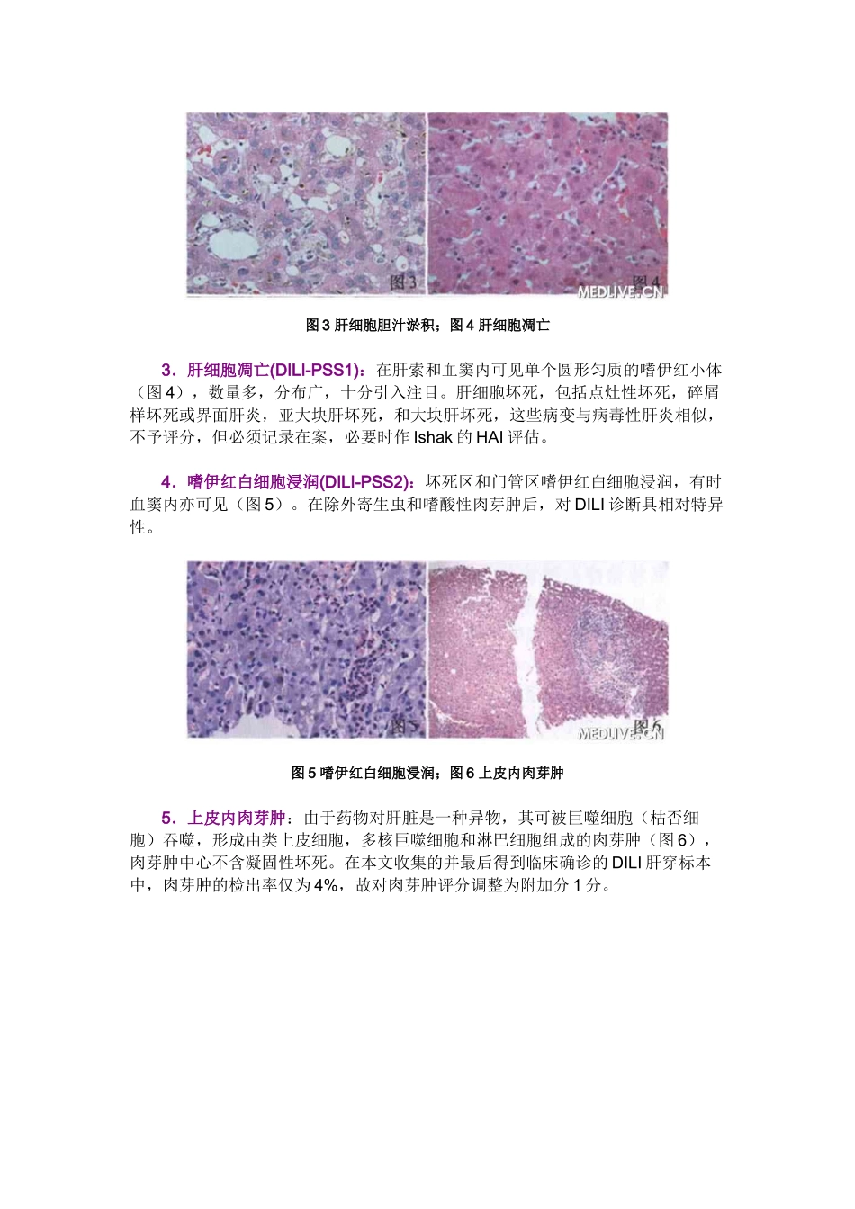 药物性肝损伤组织病理学评分_第2页