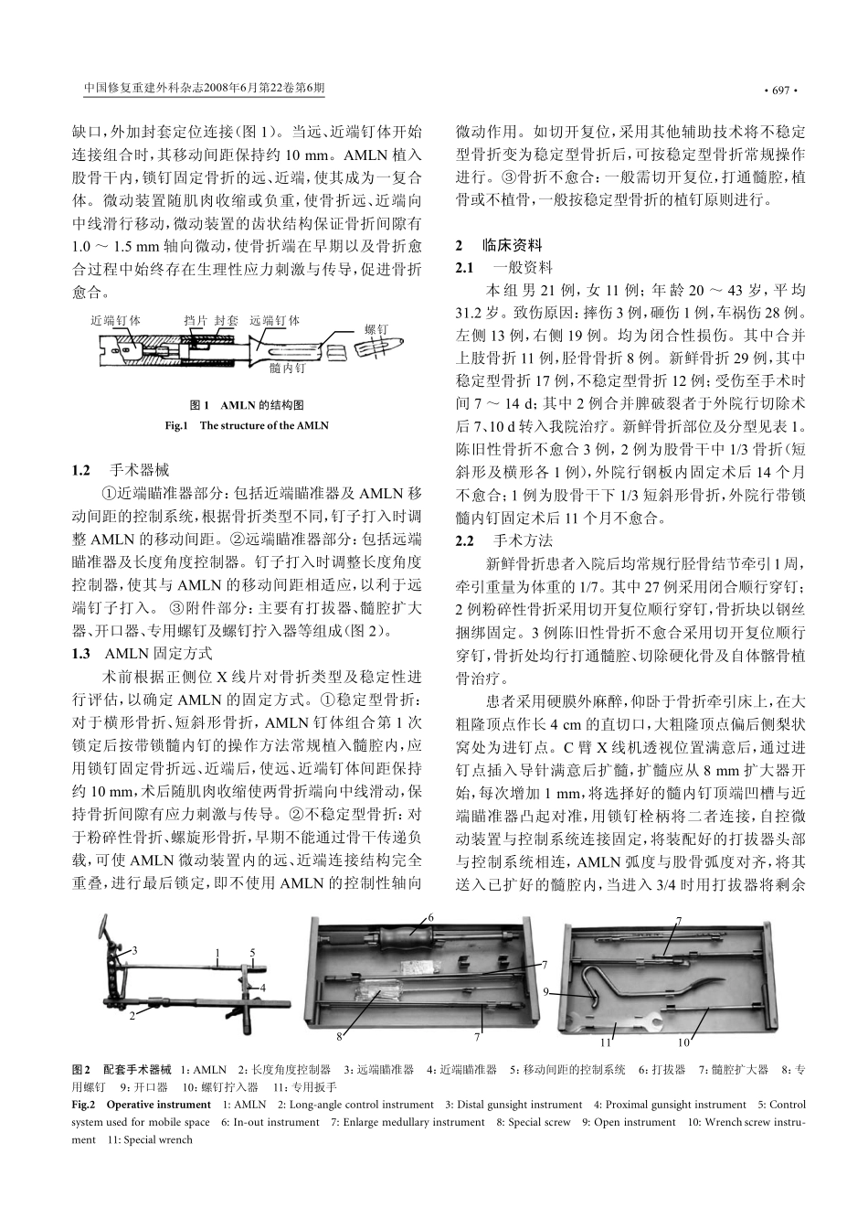 自控微动带锁髓内钉在股骨干骨折中的应用_第2页