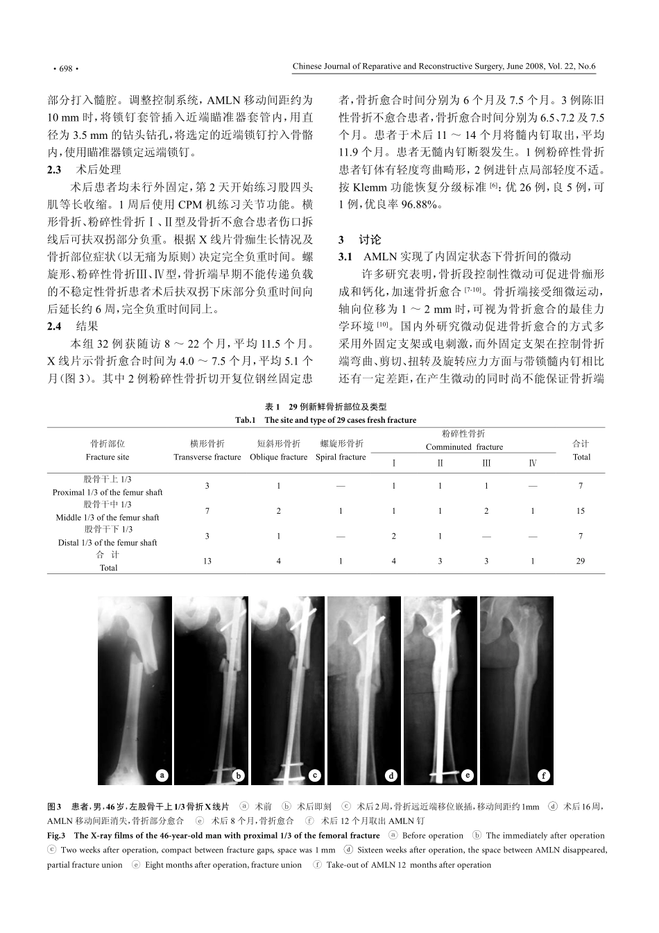 自控微动带锁髓内钉在股骨干骨折中的应用_第3页