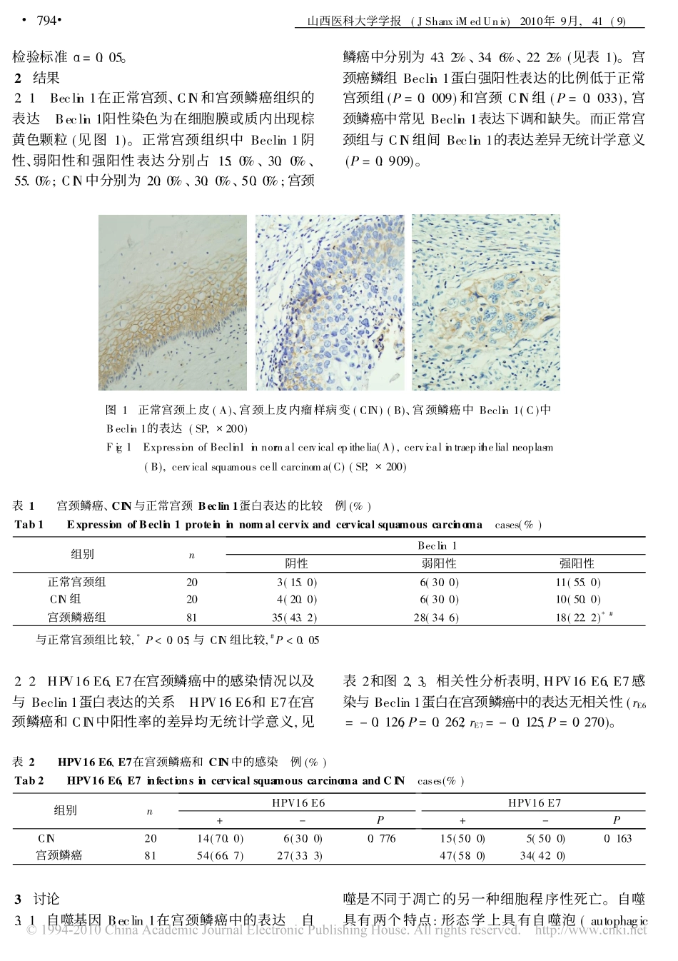 自噬基因Beclin1在宫颈鳞癌中的表达及其与HPV感染的关系_第3页