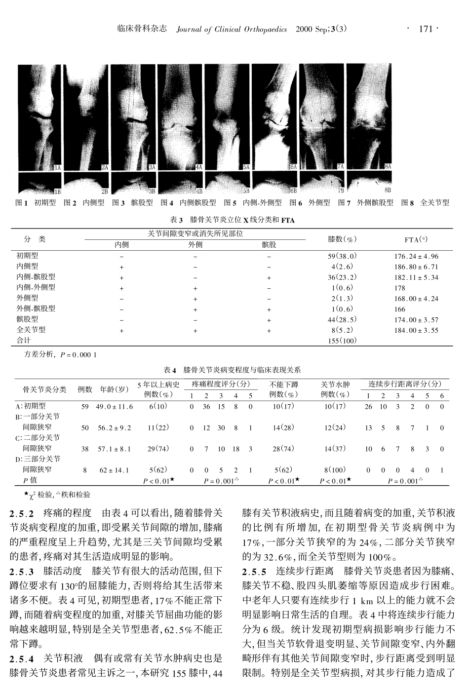 膝骨关节炎病因、X线片及临床表现分析_第3页