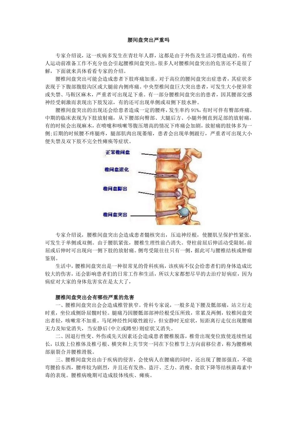 腰间盘突出严重吗_第1页