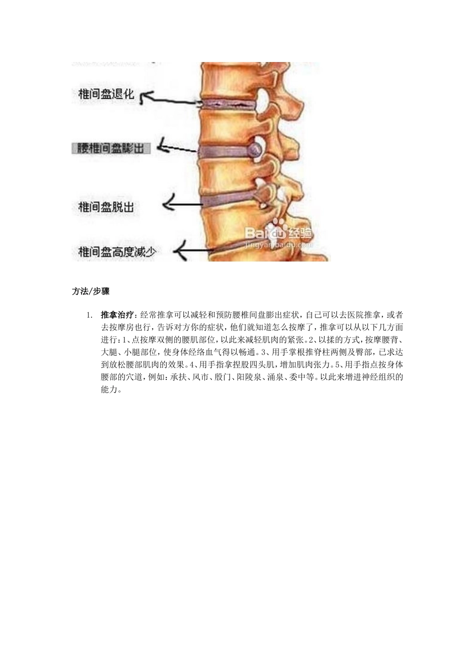 腰病的防治方法_第2页