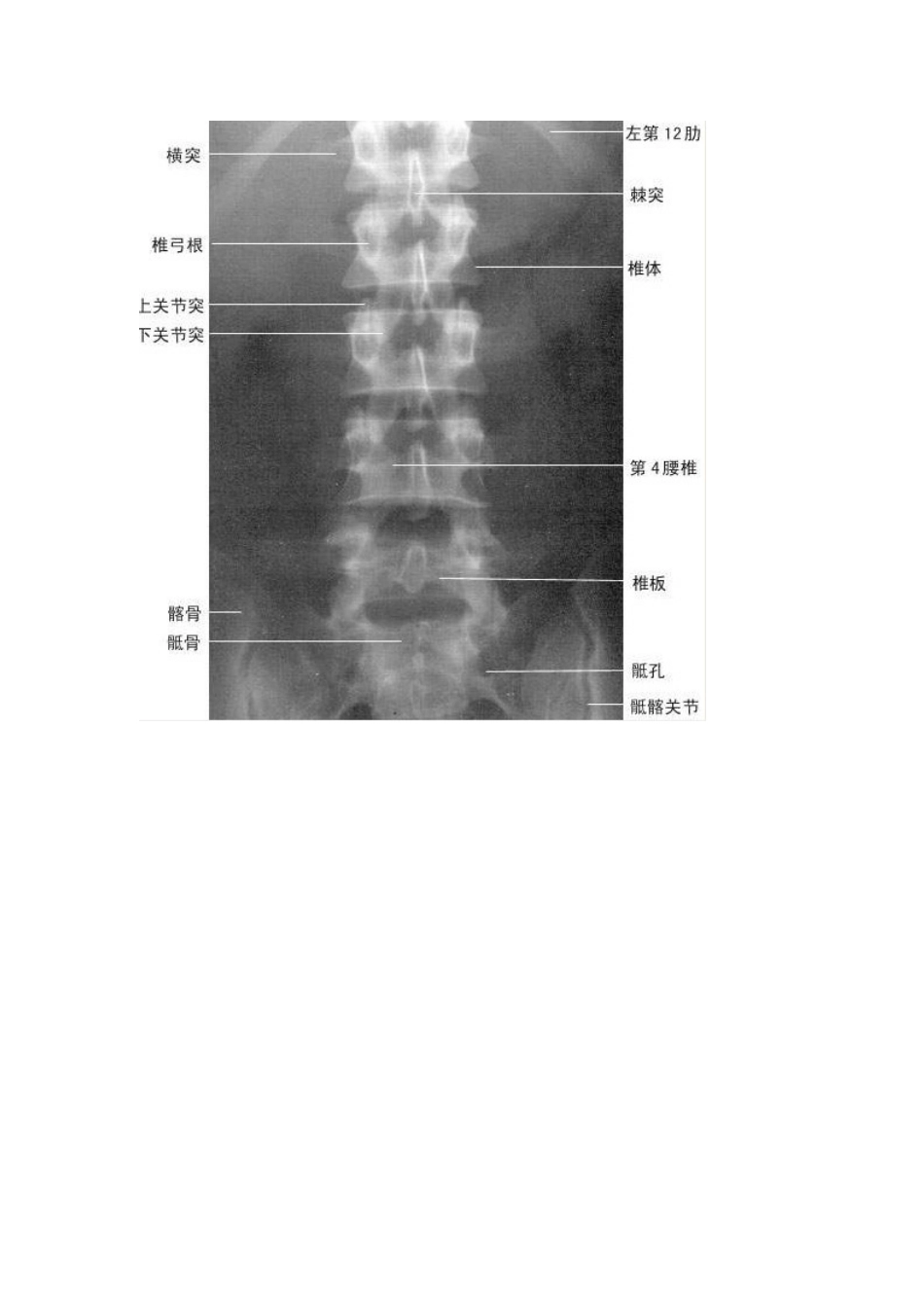 腰椎间盘突出有什么感觉_第3页