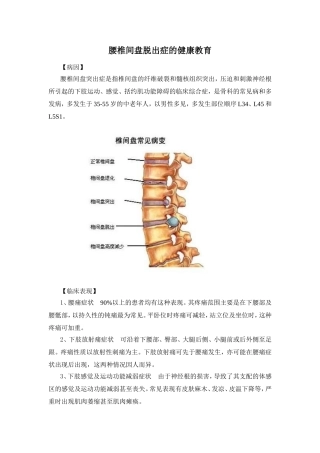 腰椎间盘突出健康指导