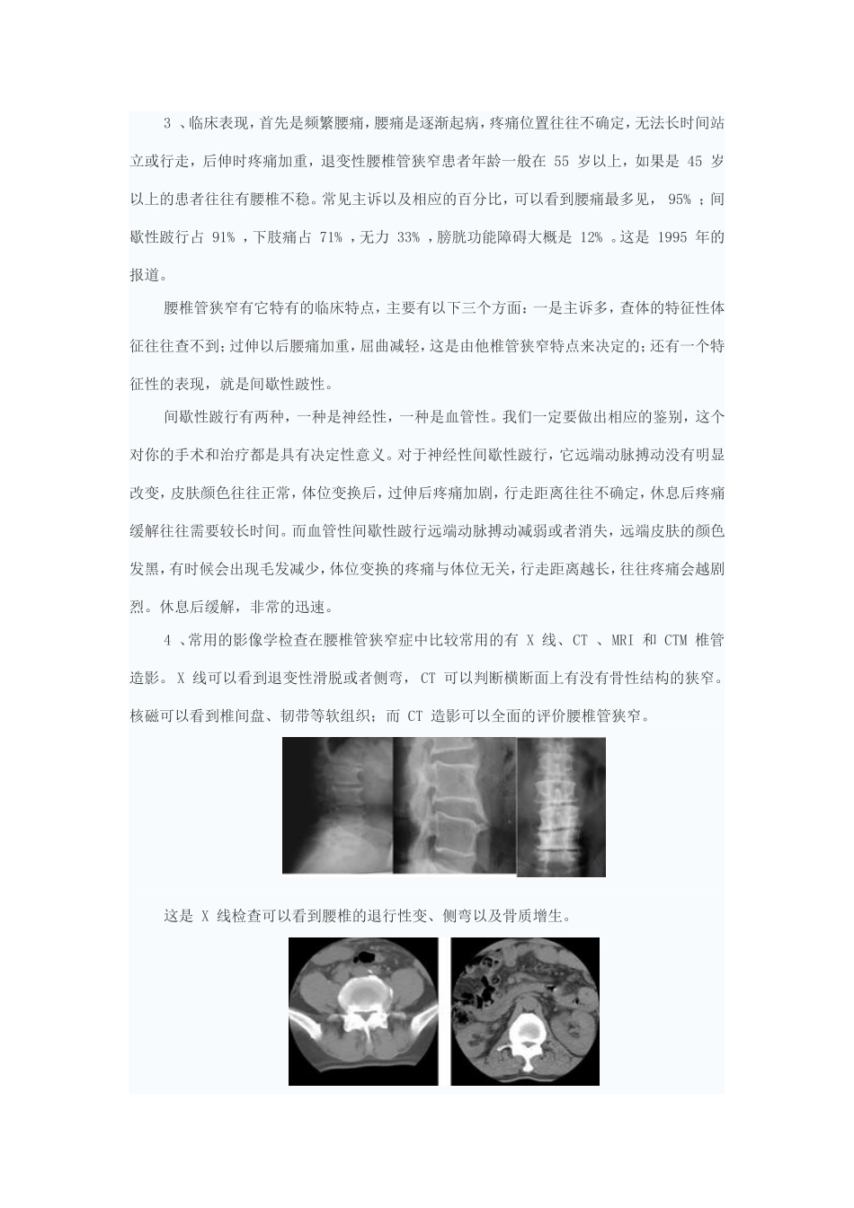 腰椎退变性疾病的诊疗.doc_第3页