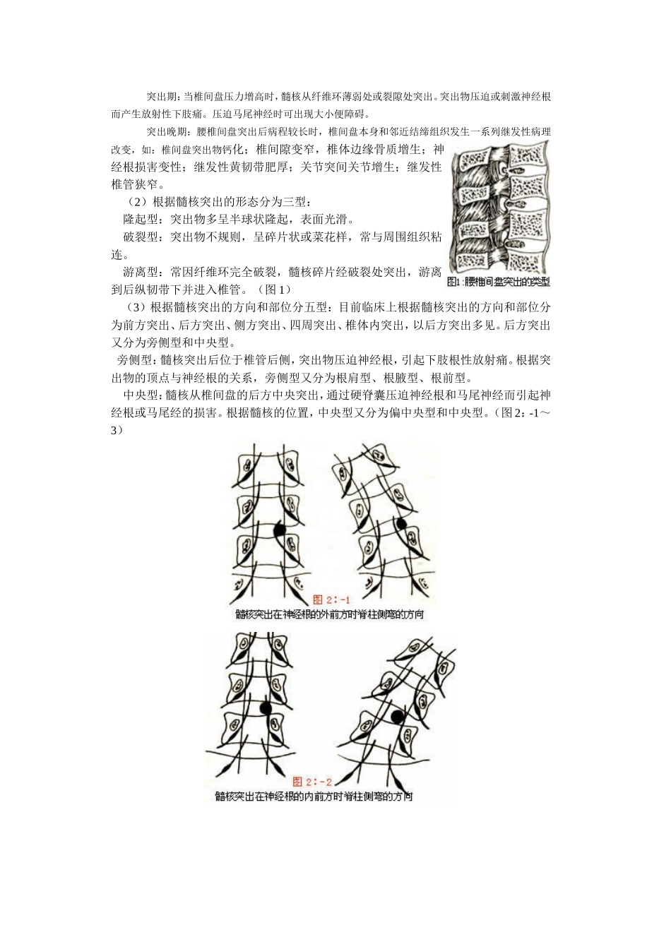 腰椎间盘突出_第3页