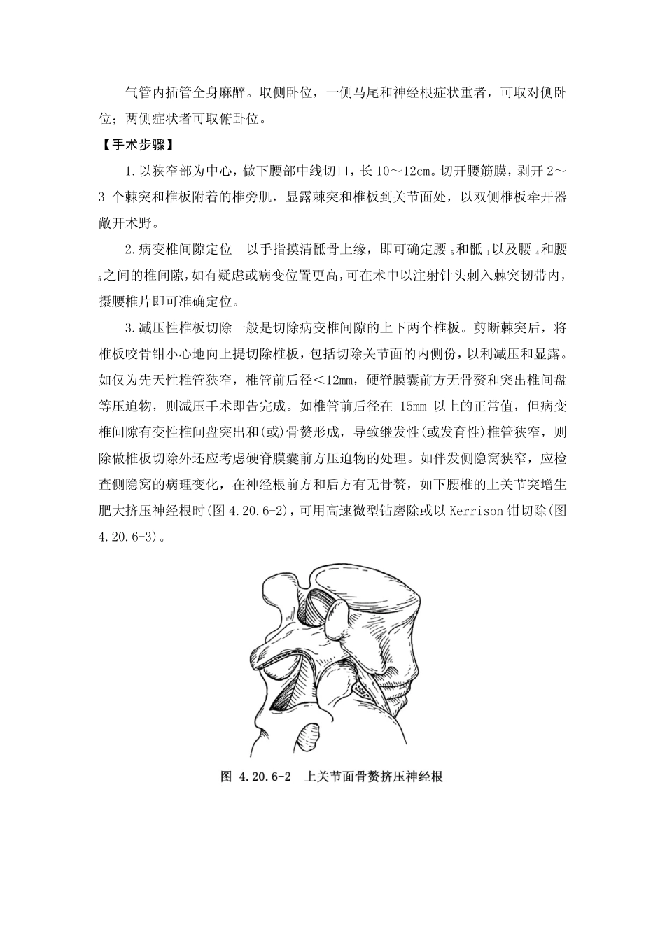 腰椎狭窄手术_第3页