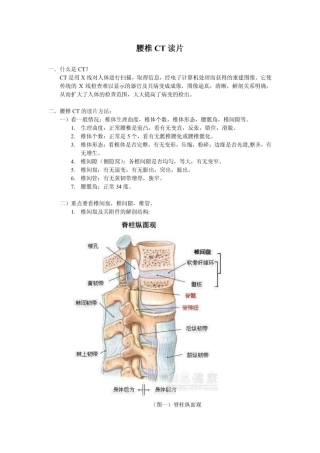腰椎CT读片