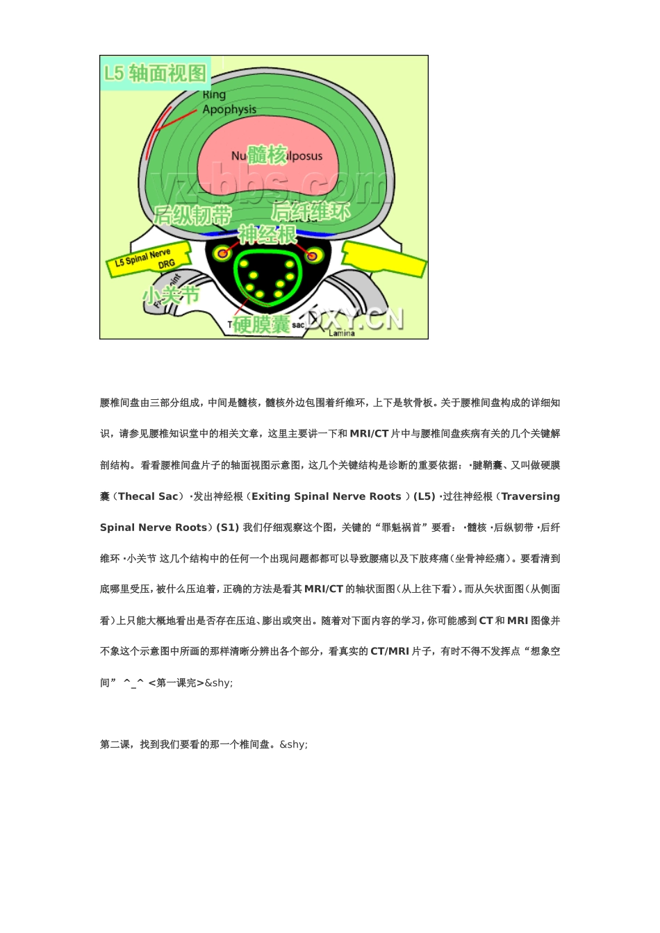 腰椎CT和MRI教程_第2页