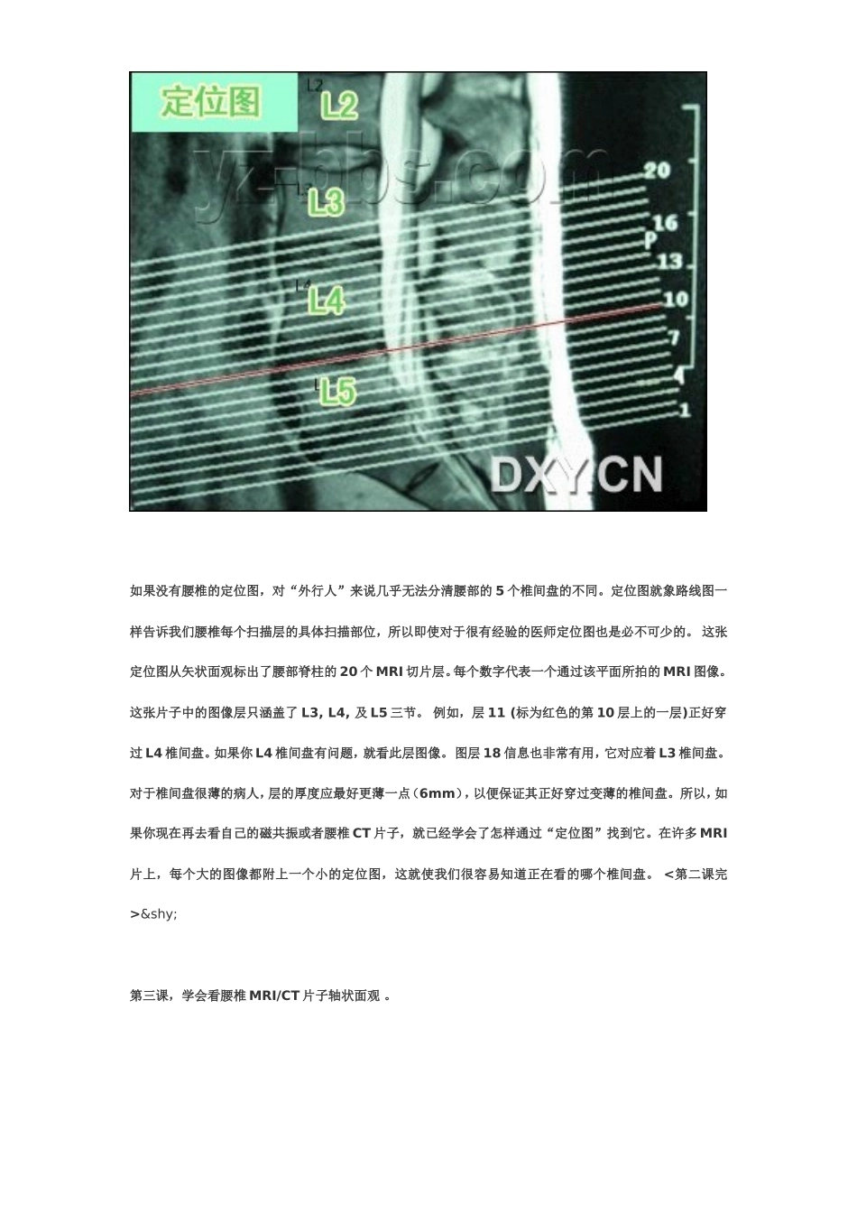 腰椎CT和MRI教程_第3页