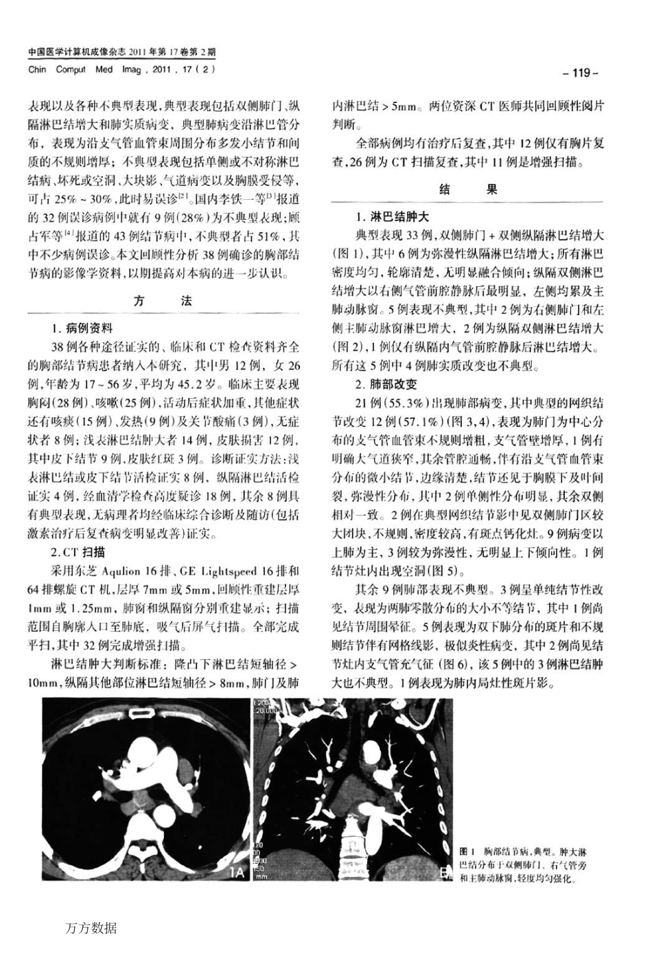 胸部结节病CT影像表现_第2页