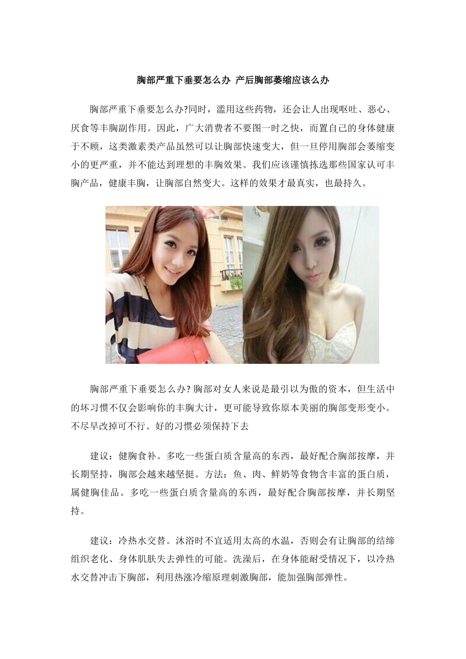 胸部严重下垂要怎么办 产后胸部萎缩应该么办_第1页