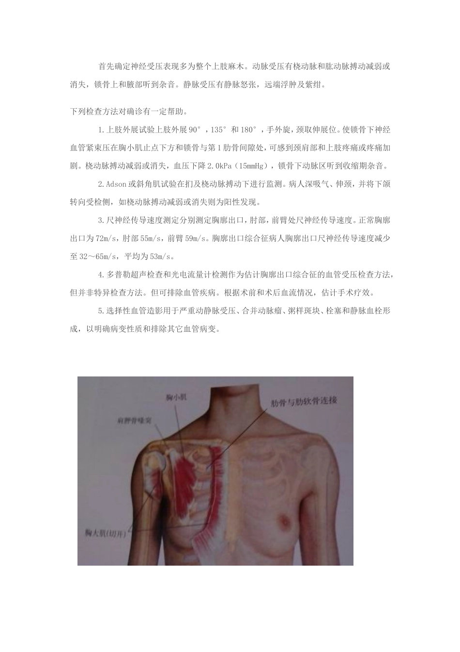 胸廓出口综合征_第2页