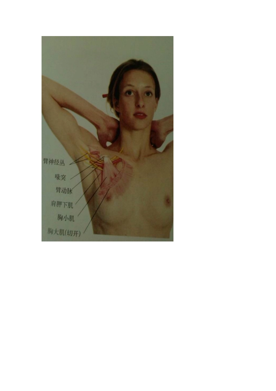 胸廓出口综合征_第3页