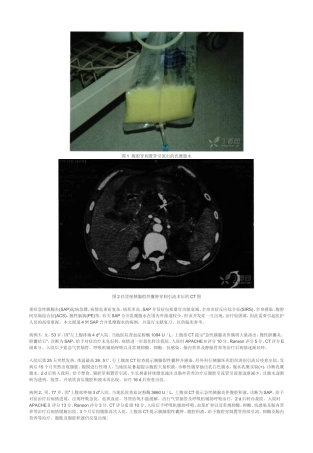 胰腺炎乳糜性腹水
