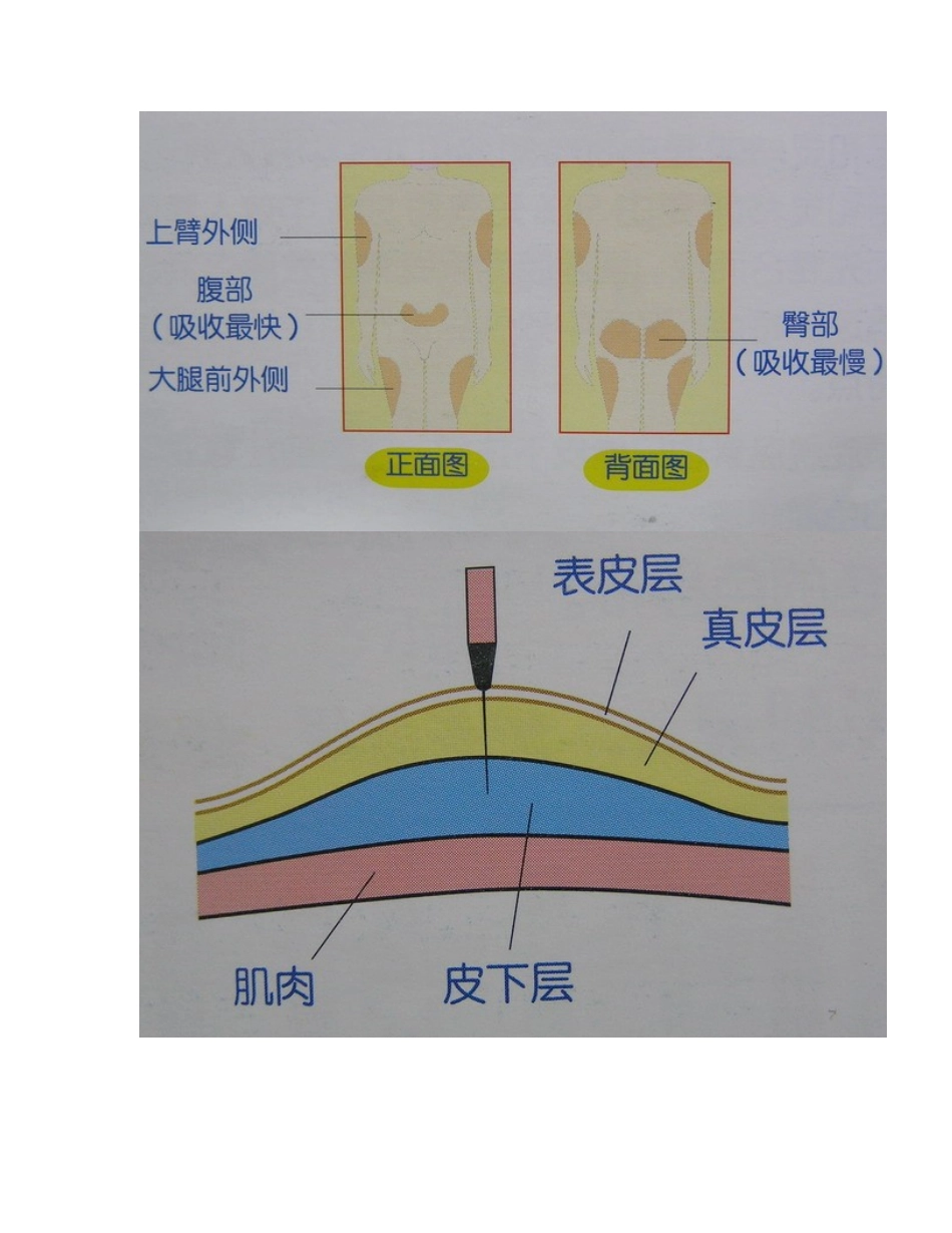胰岛素注射方法示意图_第3页