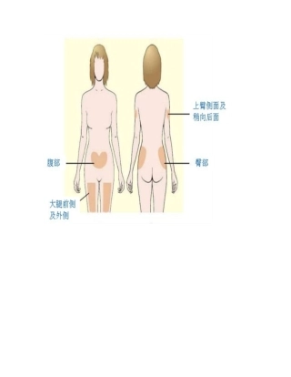 胰岛素注射方法示意图