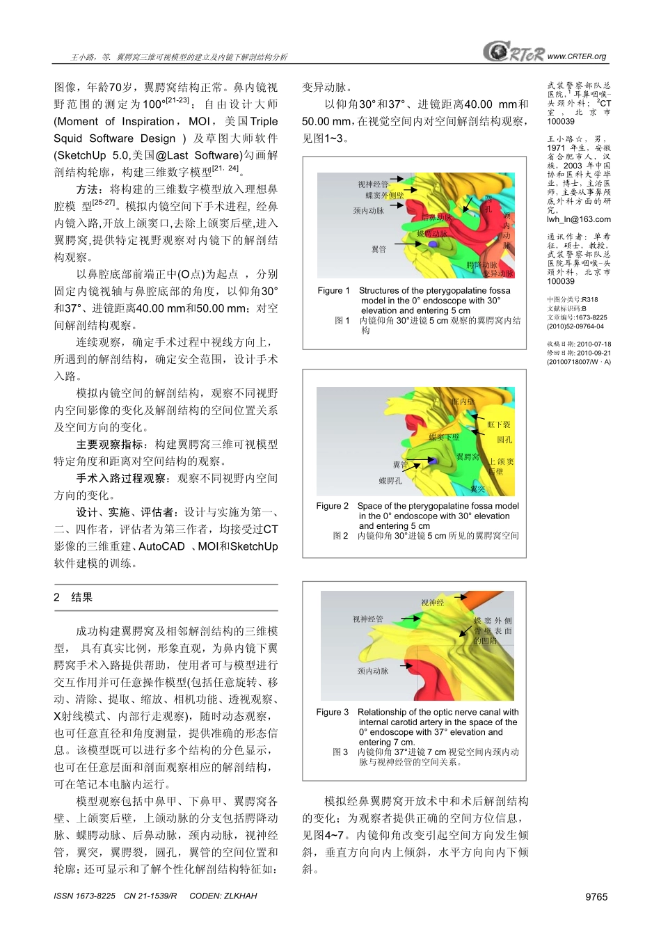 翼腭窝三维可视模型的建立及内镜下解剖结构分析_第2页