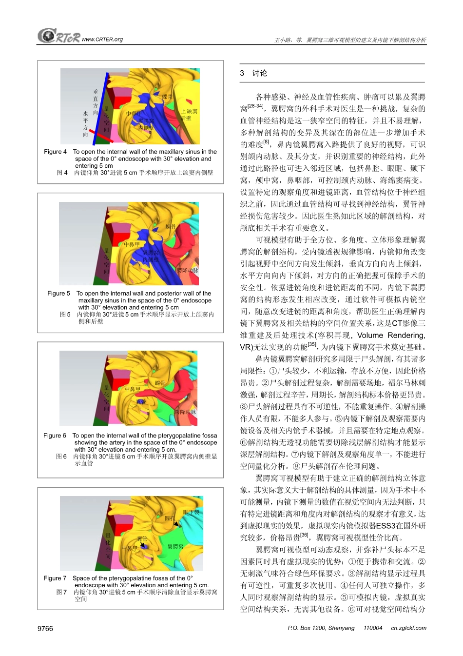 翼腭窝三维可视模型的建立及内镜下解剖结构分析_第3页