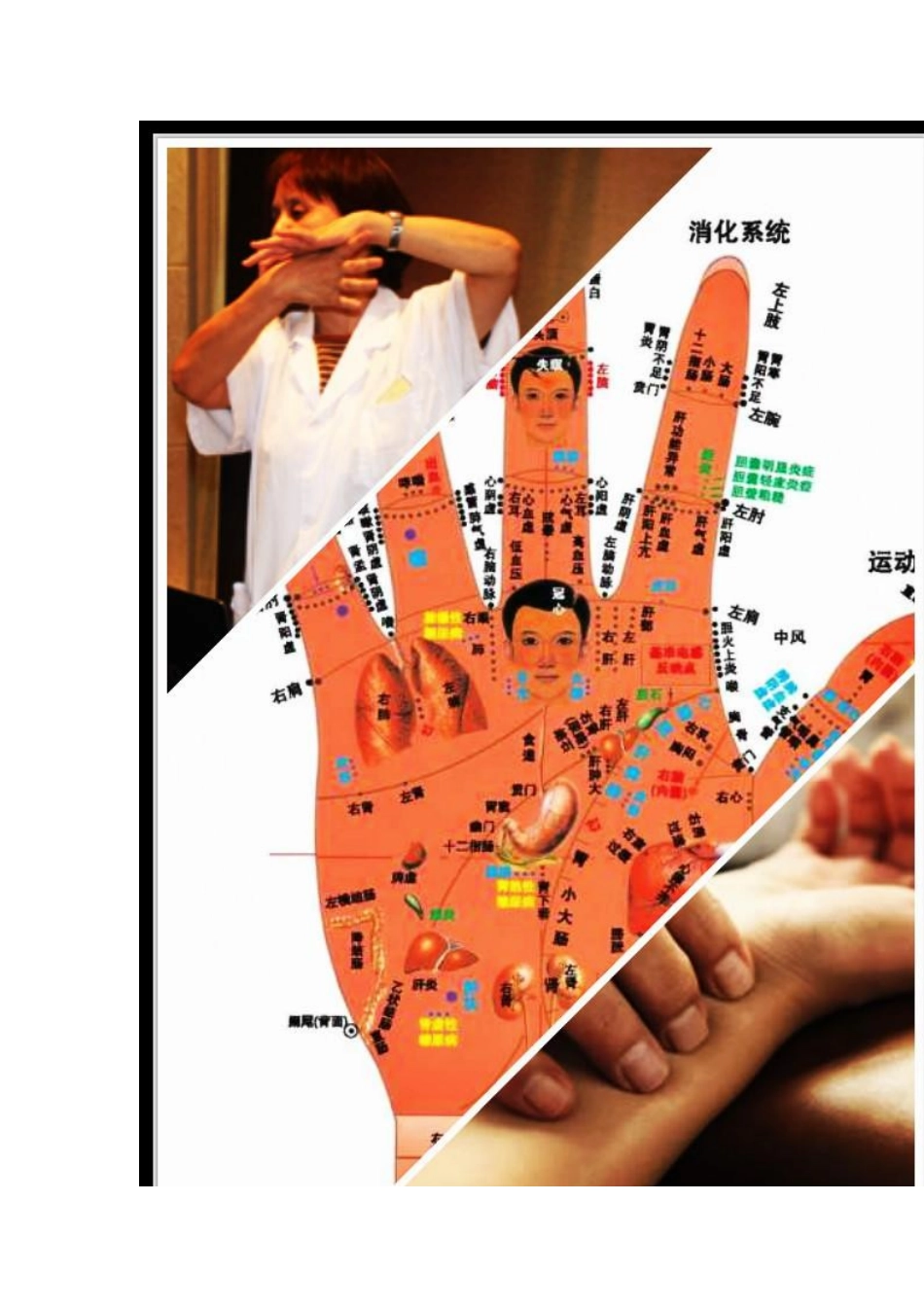 网传“手部神图”能看出全身疾病,是真的吗？_第2页