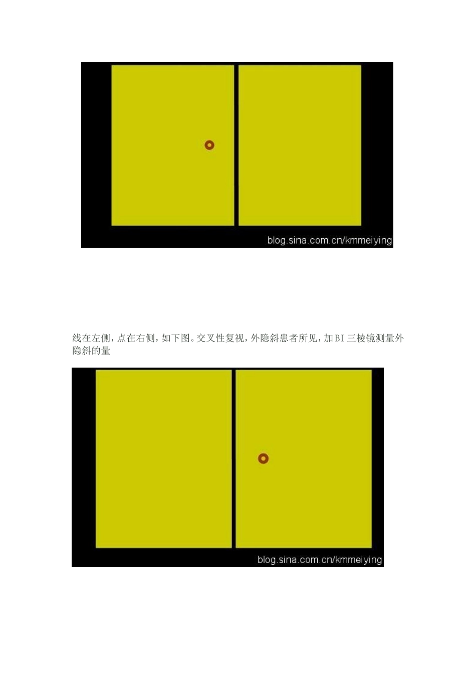 综合验光仪做视觉功能检查方法隐斜检查_第2页