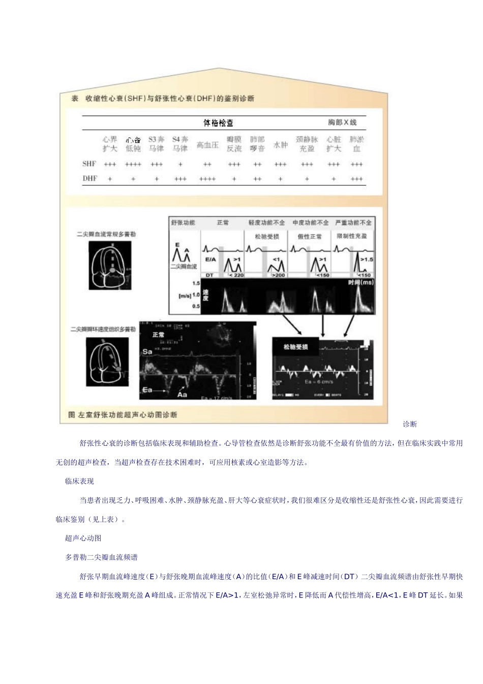 细说舒张性心力衰竭_第2页