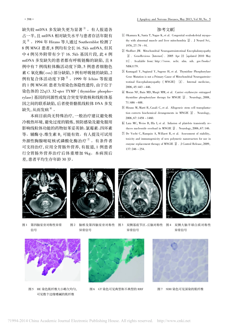 线粒体神经胃肠型脑肌病的临床和病理分析_许二赫_第3页