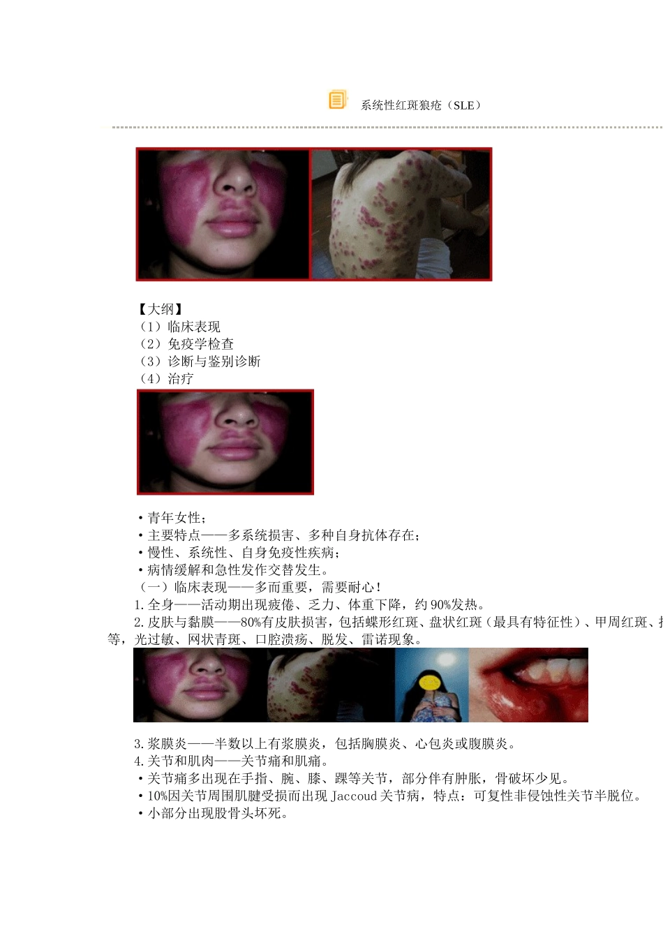 系统红斑基础 Microsoft Word 文档_第1页