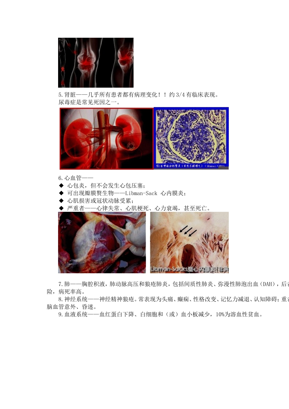 系统红斑基础 Microsoft Word 文档_第2页