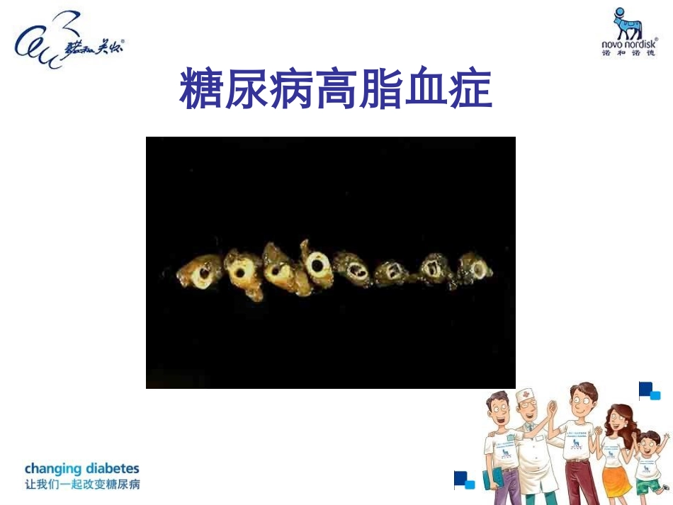 糖尿病高脂血症_第2页