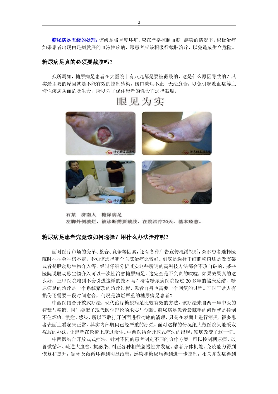 糖尿病烂脚中医怎么治疗_第2页