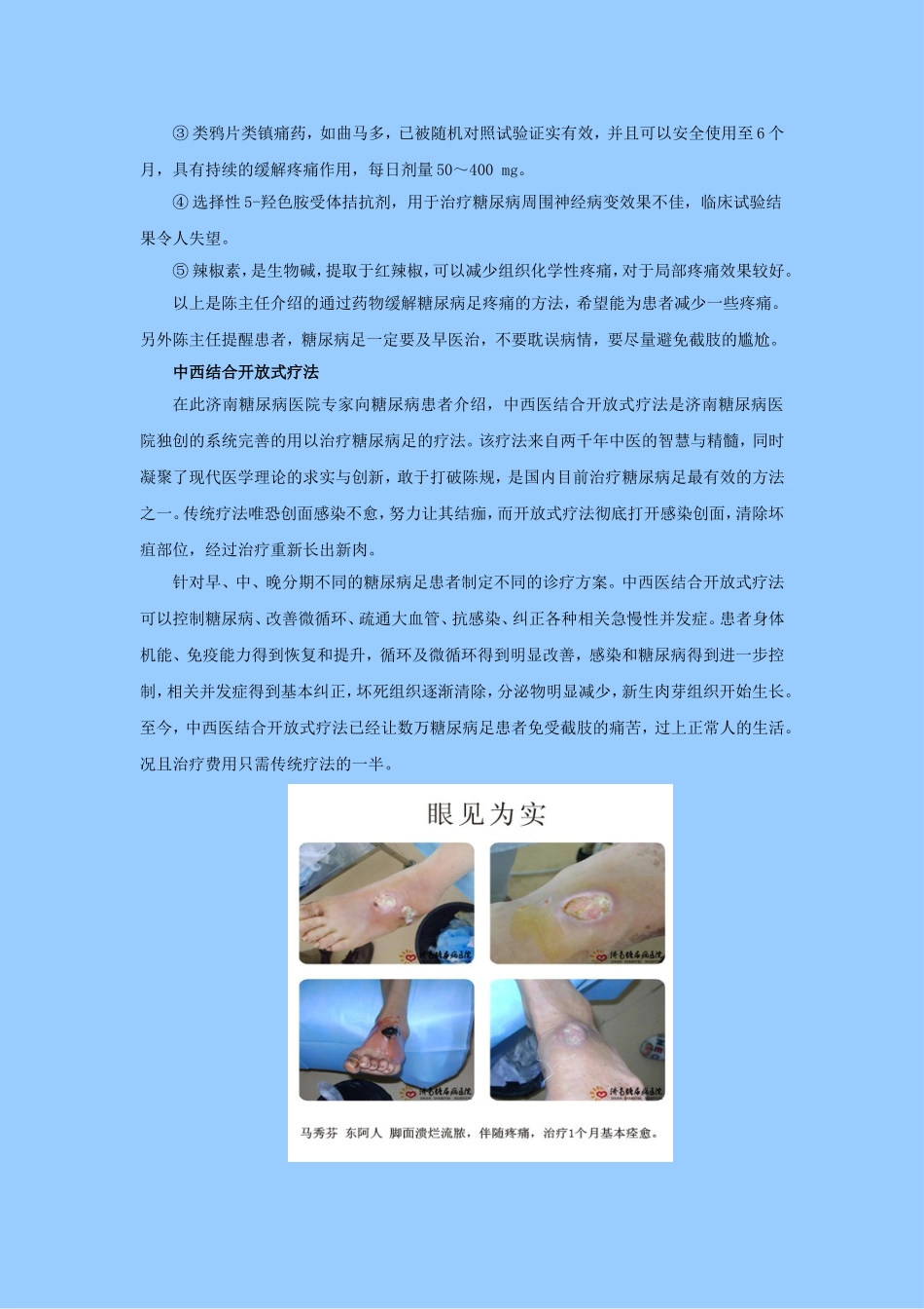 糖尿病患者下肢疼痛如何治疗_第2页