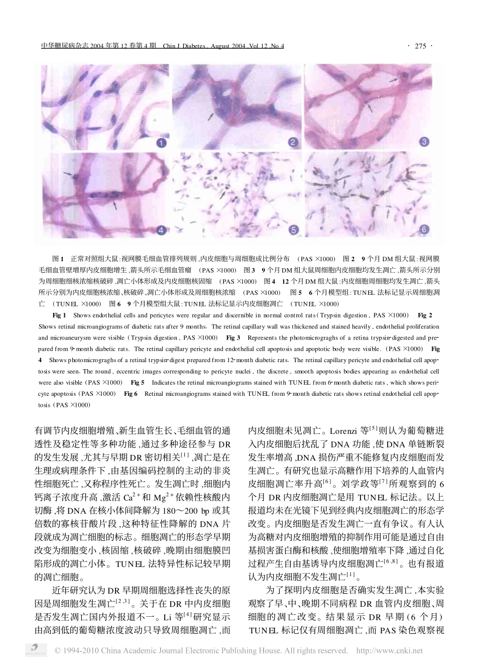 糖尿病大鼠视网膜病变细胞凋亡的观察_第3页