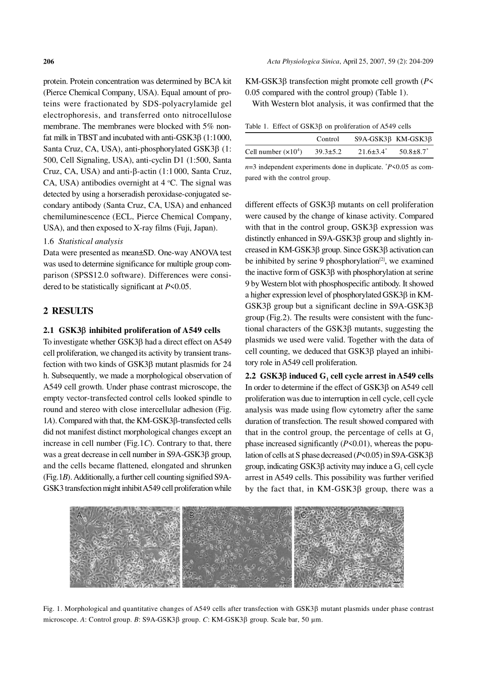 糖原合酶激酶3β以cyclin D1依赖性方式引发人肺腺癌细胞株A549细胞周期阻滞_第3页