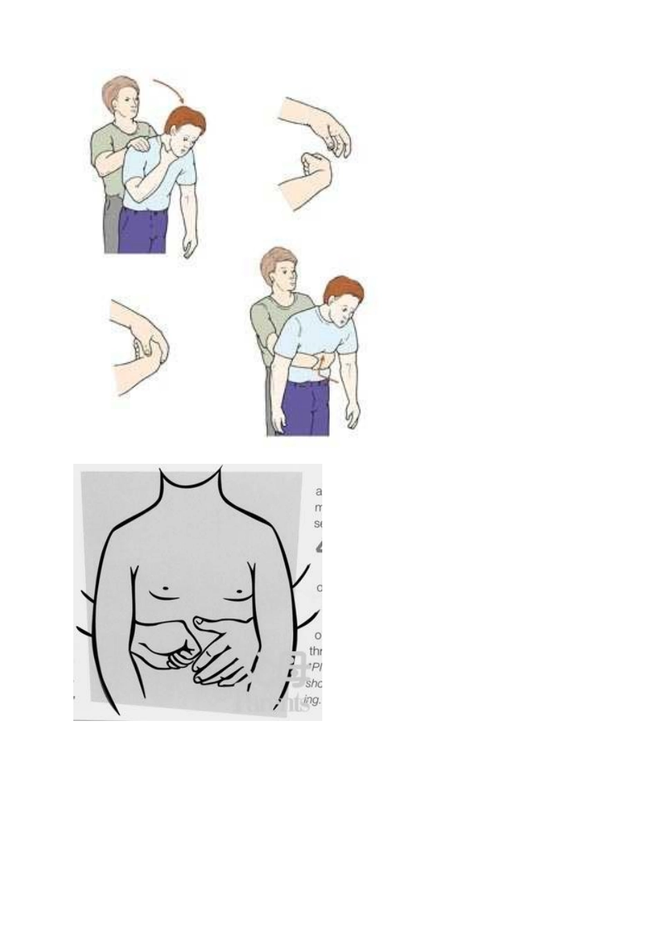 窒息急救措施_第2页