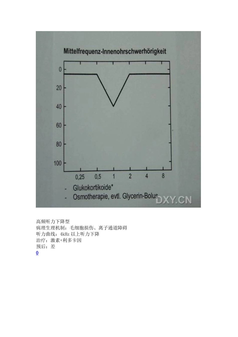 突发性耳聋的分型与治疗_第3页