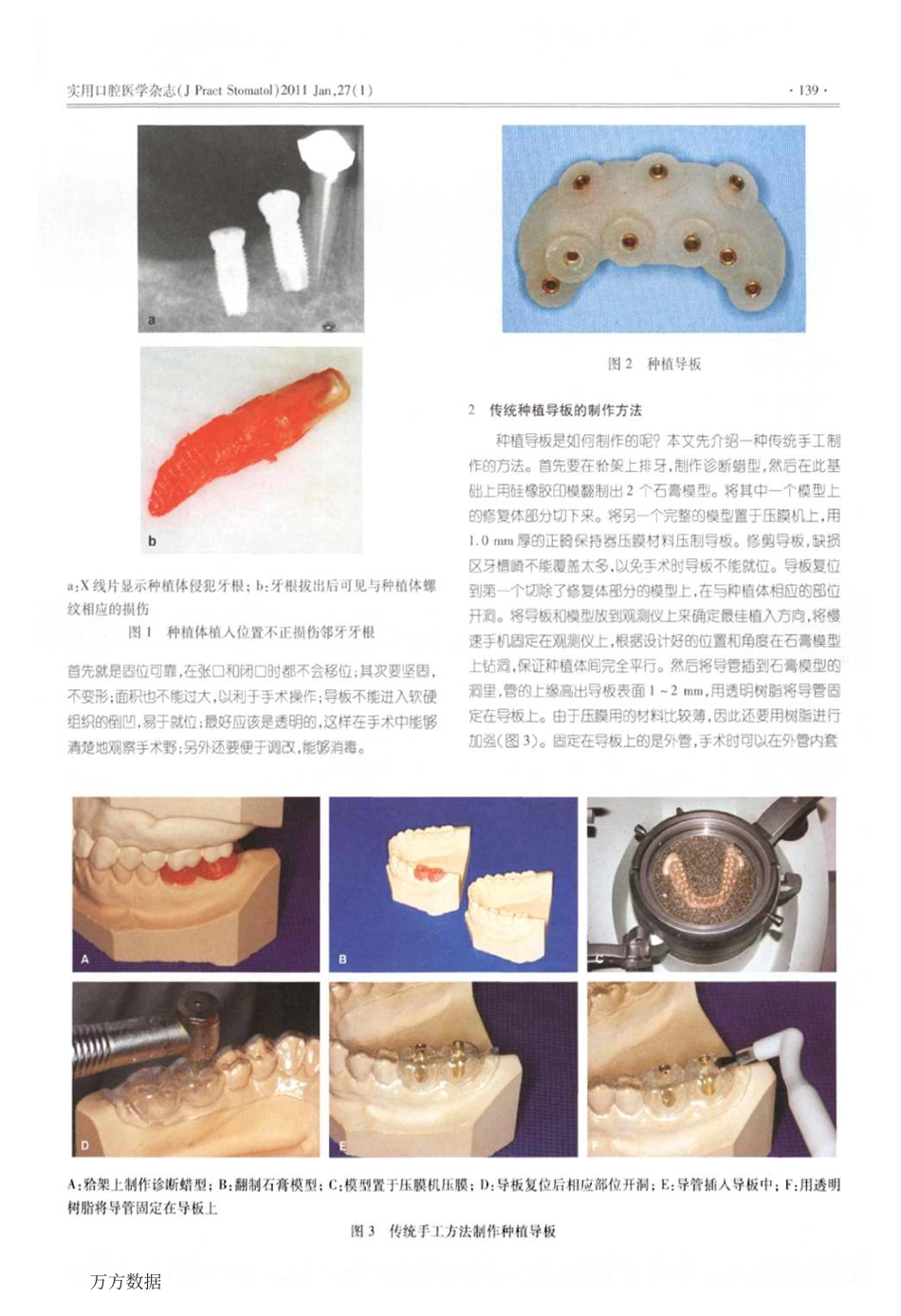 种植导板的制作及CADCAM技术的应用_第2页