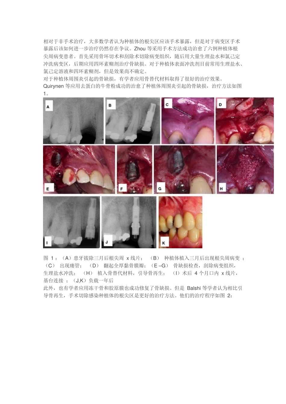 种植体周围炎_第3页