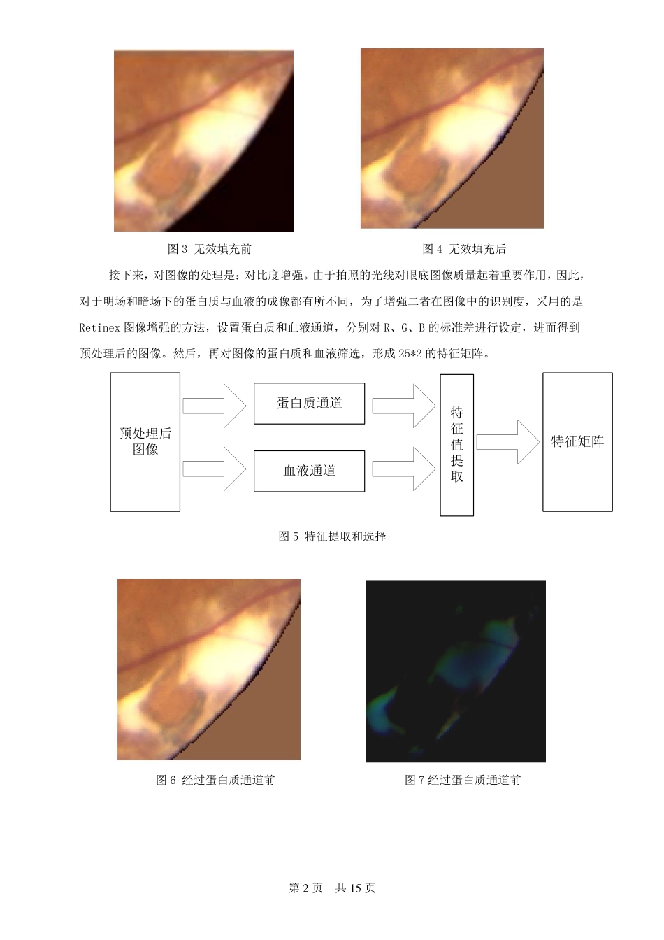 眼底图像的病变识别_第2页