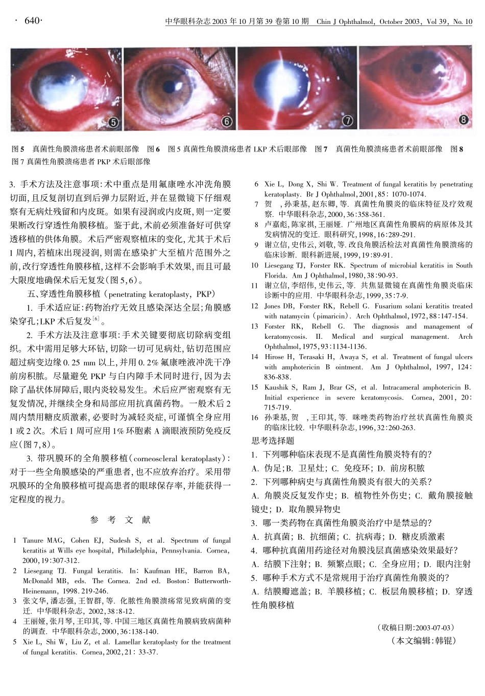真菌性角膜炎_第3页