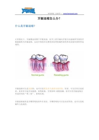 牙龈萎缩怎么办
