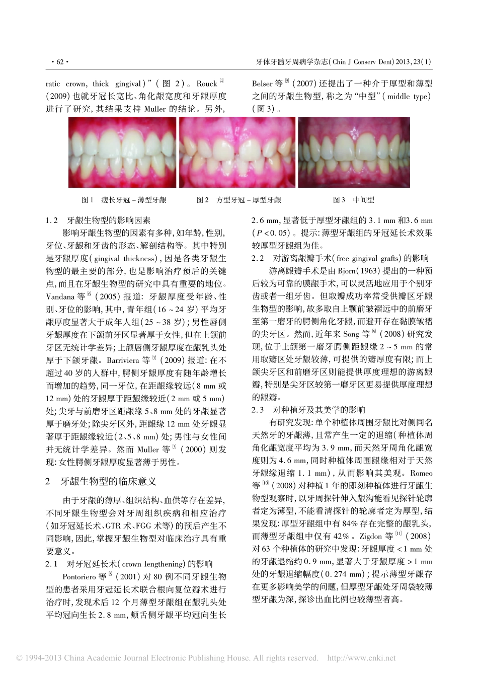 牙龈生物型的临床意义和评估方法_第2页