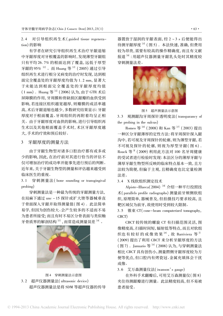 牙龈生物型的临床意义和评估方法_第3页