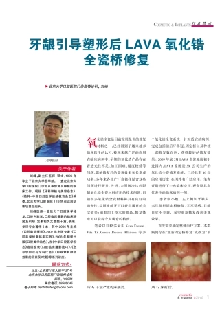 牙龈引导塑形后LAVA氧化锆 全瓷桥修复