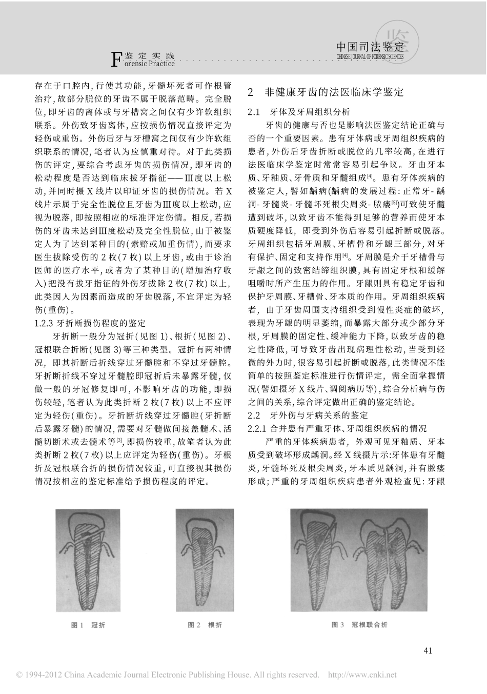 牙损伤的法医临床学鉴定_第2页